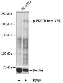 PDGFRb (Phospho-Y751) antibody