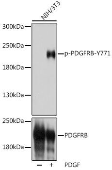 PDGFRB (Phospho-Y771) antibody