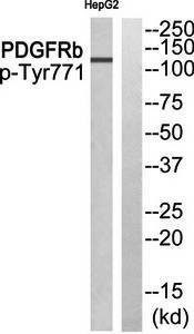 PDGFR beta (phospho-Tyr771) antibody