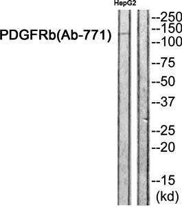 PDGFRb antibody