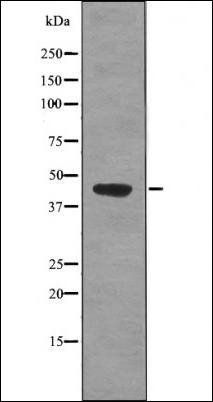 PDHA1/2 (Phospho-Ser293/291) antibody