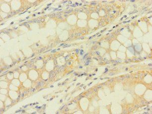 PDHA1 Antibody