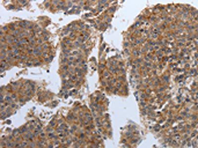 PDIA2 antibody