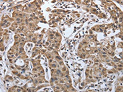 PDIA2 Antibody