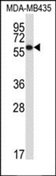 PDIA5 antibody