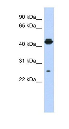 PDIK1L antibody