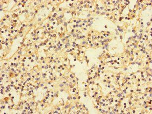 PDIK1L Antibody