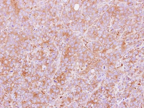 PDIR Rabbit Polyclonal Antibody