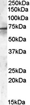 Goat anti-PDK1 Antibody