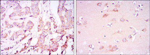 PDK1 Antibody