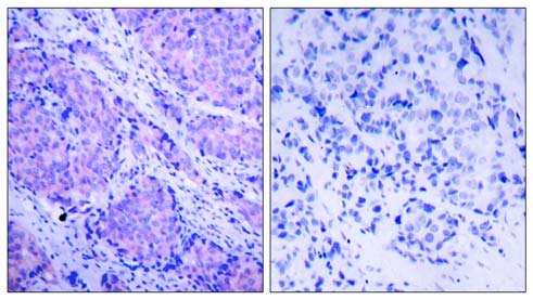 PDK1 (Phospho-Ser241) Antibody