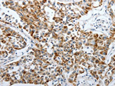 PDK2 Antibody
