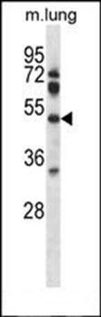 Pdk4 antibody