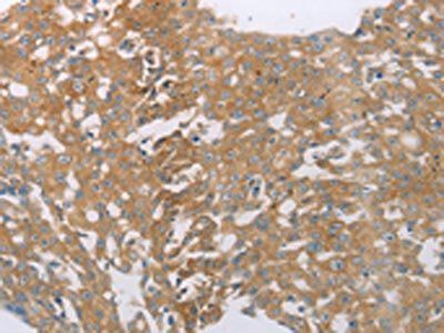 PDK4 Antibody