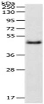 PDK4 Antibody