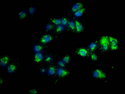 PD-L1 antibody