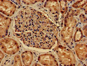 PDLIM2 Antibody