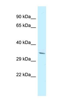 PDLIM7 antibody