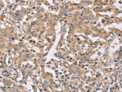 PDLIM7 Antibody
