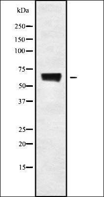 PDP1 antibody