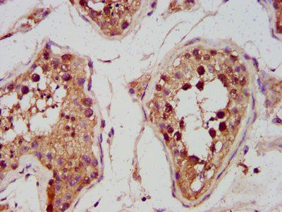 PDP1 Antibody