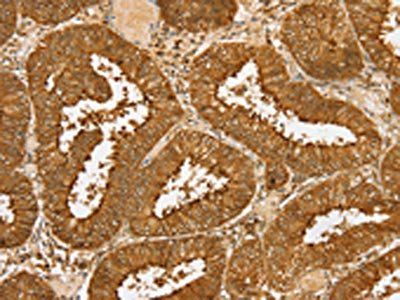 PDP1 Antibody