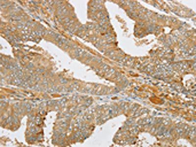 PDP1 Antibody