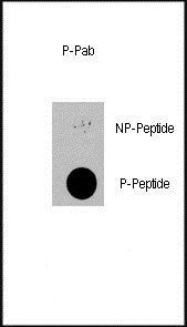 PDPK1 (phospho-Ser396) antibody