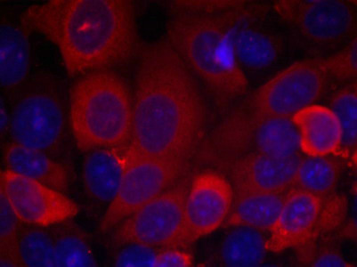 PDPK1 (Ab-241) Antibody
