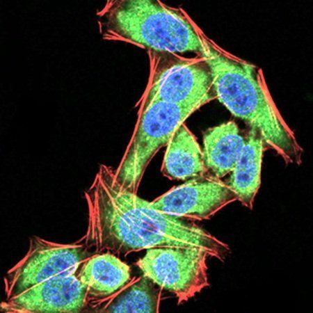 PDPK1 Antibody