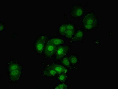 PDPK1 Antibody