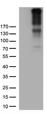 PDPN antibody