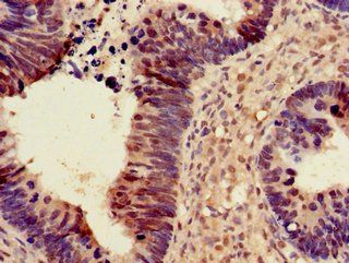PDS5A Antibody