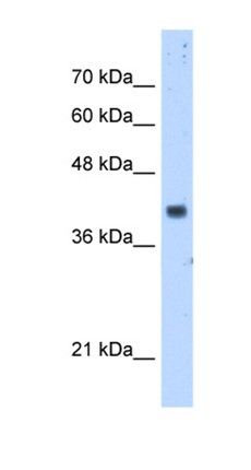 PDSS1 antibody