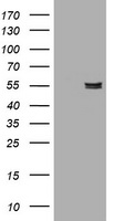 PDSS2 antibody