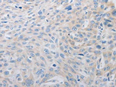 PDX1 Antibody