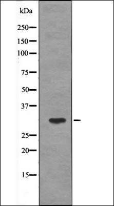 PDX1 (Phospho-Ser61) antibody