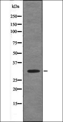 PDX1 (Phospho-Ser66) antibody