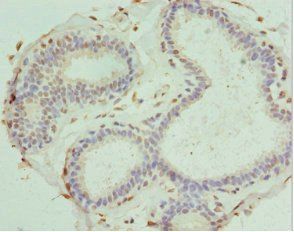 PDXK antibody