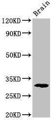 Pdxp antibody