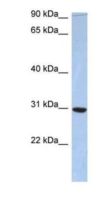 PDZD9 antibody