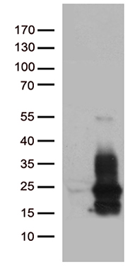Pea3 (ETV4) antibody