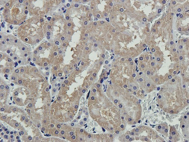 PEAK1 Rabbit Polyclonal Antibody