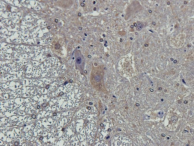 PEAK1 Rabbit Polyclonal Antibody