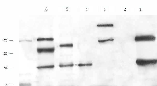 PEAK1 antibody