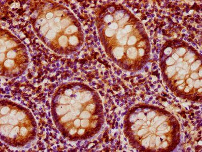 PEAK1 Antibody