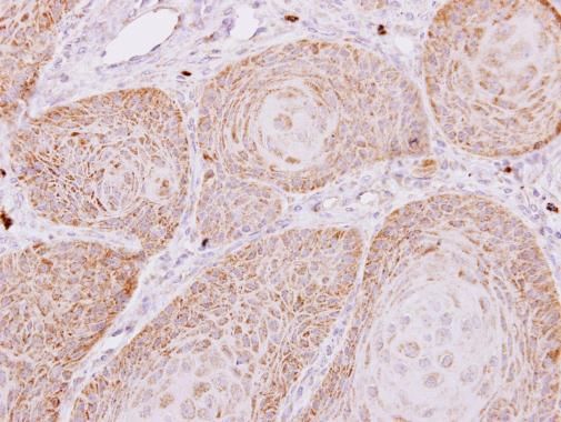 PECR Rabbit Polyclonal Antibody