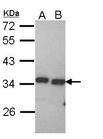 PECR Rabbit Polyclonal Antibody