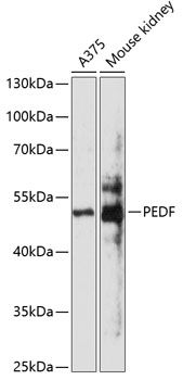 PEDF antibody