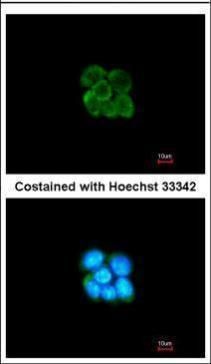 Alpha 2 Antiplasmin antibody [N3C3]